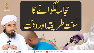 Hijama Lagwane Ka Sunnat Tariqa Aur Waqt | Solve Your Problems | Ask Mufti Tariq Masood