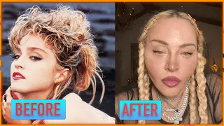 Famous People And Plastic Surgery: Then and Now