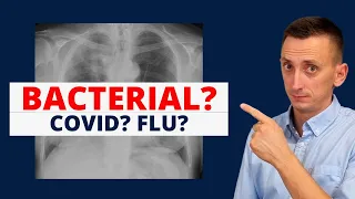 Covid, Influenza, Pneumonia?