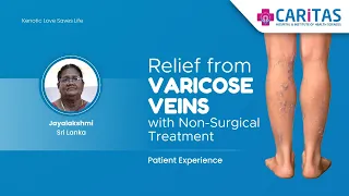 Relief from Varicose Veins with Non-Surgical Treatment #patienttestimonial #srilanka