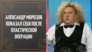 Александр Морозов показал себя после пластической операции .