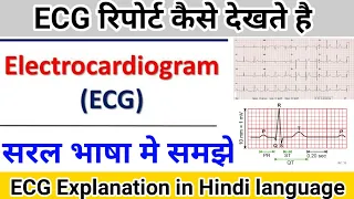 ECG report कैसे देखते है || Electrocardiogram explanation in hindi language