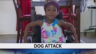 Mom wants dogs put down after girl, 5, attacked