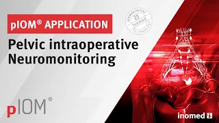 Pelvic Intraoperative Neuromonitoring pIOM - Application - inomed