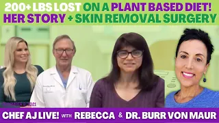 REBECCA LOST OVER 200 POUNDS ON A PLANT BASED DIET &  DR. BURR VON MAUR DID HER SKIN REMOVAL SURGERY