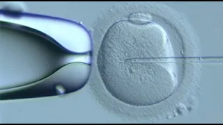 ASSISTED CONCEPTION TECHNIQUES video