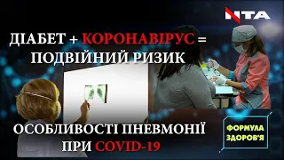 Діабетики – під прицілом COVID-19 | Вірусна пневмонія: на що зважати? | Формула здоров’я