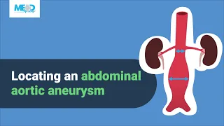 Locating Abdominal Aortic Aneurysms (AAA) on Ultrasound