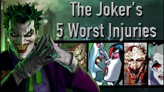 The Joker's 5 Worst Injuries (That Didn't Kill Him)