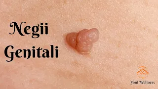 S2. Ep 31 - Negii | Verucile Genitale | Condyloma Acuminata | HPV | Boli cu transmitere sexuală