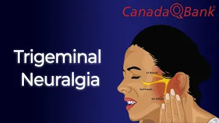 Trigeminal Neuralgia