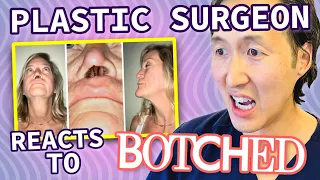 Plastic Surgeon Reacts to BOTCHED: Her Nose Is Missing!