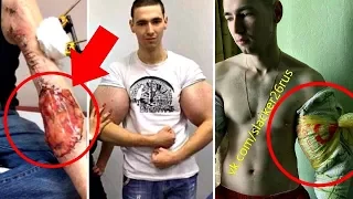 CASI PIERDE LOS BRAZOS POR USAR ESTO | CHICO SYNTHOL