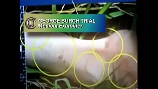 GEORGE BURCH TRIAL - 👩‍⚕️ Medical Examiner (2018)