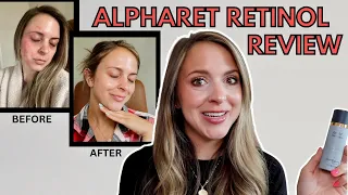ALPHARET CLEARING SERUM RETINOL: MY EXPERIENCE & 4 MONTH RESULTS: Is It Worth The Money?