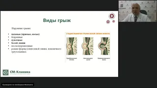 Вебинар "Грыжи белой линии живота" – Сенько.В.В.