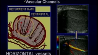 Scrotal Ultrasound