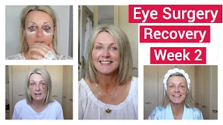 Eye Surgery Recovery/Week 2 - Vlog Style