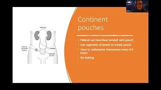 Adult Med/Surg: Urinary Diversions NEW Lecture