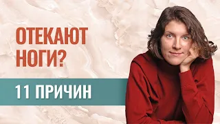 Отеки ног: 11 причин. Как самостоятельно разобраться