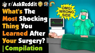 What's The Most Shocking Thing You Learned After Your Surgery?