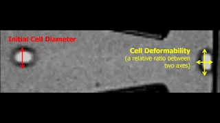 MDA-MB-231 Cell deformation