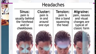 Primary and Secondary headaches, Tension, Migraine and Cluster headaches