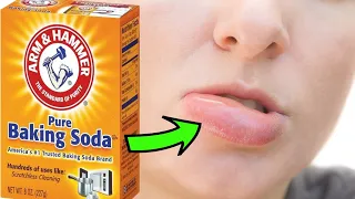 How To Get Rid Of A FAT | SWOLLEN LIPS Fast With Home Remedies