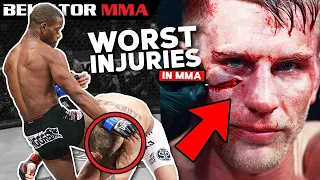 Most GRUESOME Fight Ending Injuries | Bellator MMA