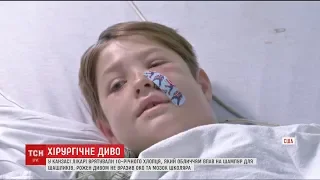 У США лікарі врятували хлопчика, якому шампур для м’яса пробив голову