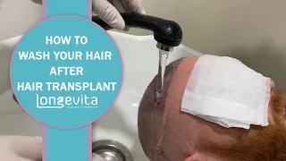 How to Wash Your Hair After Hair Transplant | Longevita