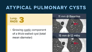 ACR Lung-RADS 2022 Atypical Pulmonary Cysts