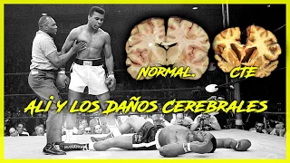 Mohamed Ali y los CTE