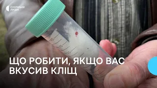 Що робити, якщо вас вкусив кліщ: поради волинського епідеміолога