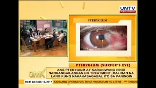 Facts about Surfer's Eye | Usapang Pangkalusugan