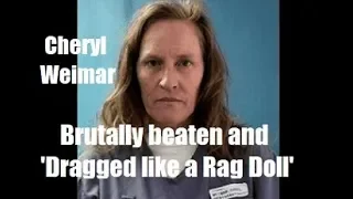 Guards Beat Female Inmate Until She Is Paralyzed From The Neck Down