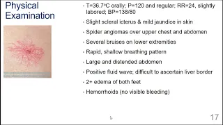 Cirrhosis Case Study- follow up to the cirrhosis lecture