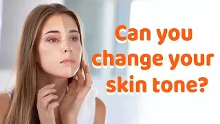 Can you change your skin tone? | FAIRNESS | BEAUTY TIPS | DR. PRADNYA SHASTRI