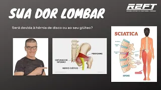 SUA DOR LOMBAR VEM DA COLUNA OU DE SEU GLÚTEO?