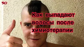 Как выпадают волосы после химиотерапии. Онкобудни