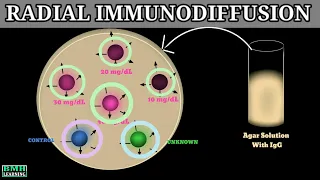 Radial Immuno Diffusion | Mansini Immuno Diffusion | Single Immuno Diffusion Assay |