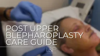 Post Upper Blepharoplasty Care - Step-By-Step Instructions From L&P Aesthetics in Palo Alto, CA