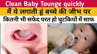 छोटे बच्चे की जीभ जल्दी साफ करने का आसान तरीका | how to clean baby tounge quickly