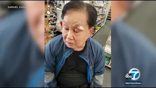 Asian-American victim of Koreatown assault terrified after suspect released within hours of arrest