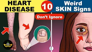 10 Unexpected Signs of Heart Disease that you Must Know