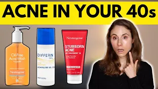 WHY YOU ARE GETTING ACNE IN YOUR 40s 😳 Dermatologist @DrDrayzday