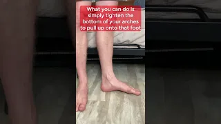 One Move to Actively Correct Flat Feet