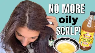 LIFE CHANGING DIY Hair mask for OILY HAIR! / NO MORE OILY SCALP!