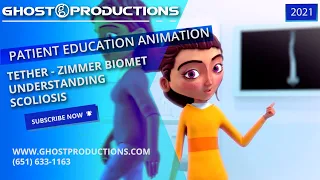 Medical Animation: Understanding Scoliosis  - Tether - Zimmer Biomet