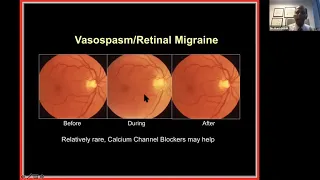 Lecture:  Recent Changes in Management of Common Neuro-ophthalmological Conditions